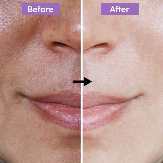 DREAM BRIGHTENING CREAM